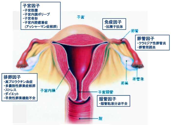 図1．女性側の不妊原因